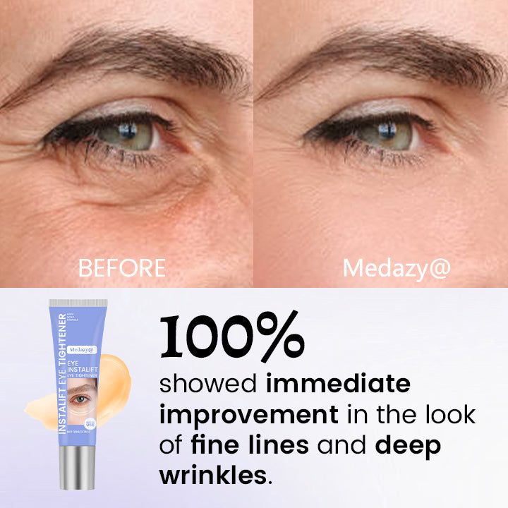 Medazy® InstaLift Eye Tightener – 10 Seconds to Younger, Fresher Eyes