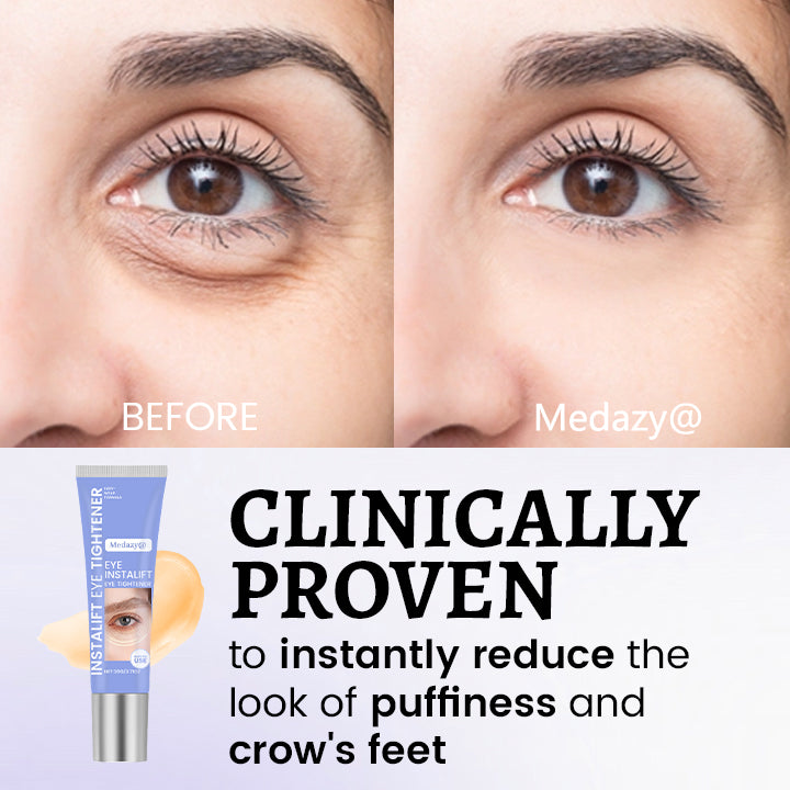 Medazy® InstaLift Eye Tightener – 10 Seconds to Younger, Fresher Eyes