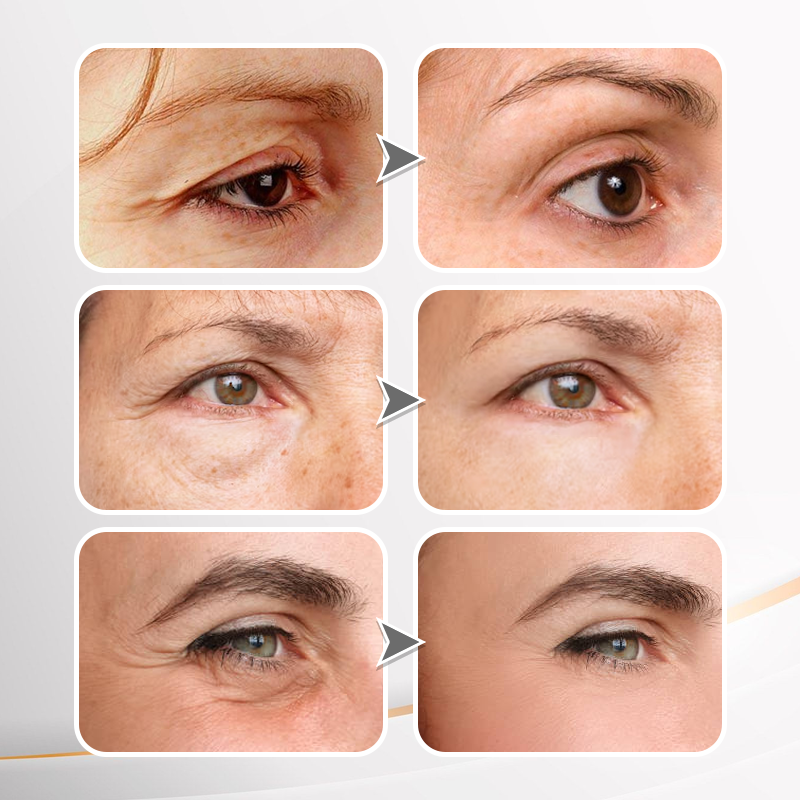 ๐ธ Perfection Primer Tightener โ New Formula, Ultimate Lift & Smooth Finish โจ