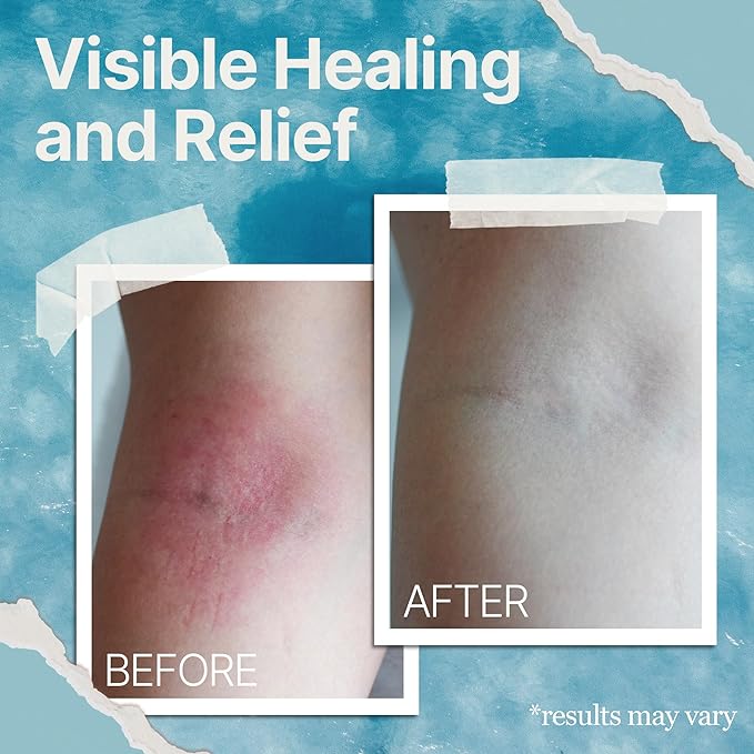 Skavix™ Ultimate Repair Soothing Cream