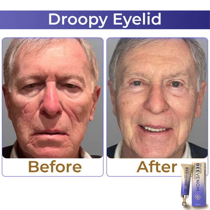 ✨ 【Official Flagship Store】LOVILDS® Collagen+ Bee Venom Roller Eye Cream(Dermatologist Approved)